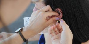 Academia de Saúde do Vieira oferece auriculoterapia