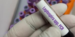 Saúde pede atenção quanto a possíveis casos de leptospirose em Jaraguá