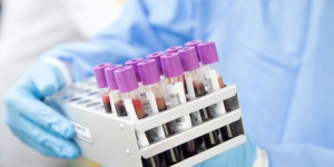 Justiça de Santa Catarina disponibiliza 1.600 kits para coleta de DNA em audiências