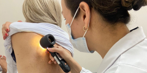Melanoma preocupa em SC e prevenção é reforçada