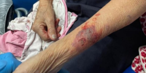 Filho é preso após agredir mãe idosa com Alzheimer em Jaraguá do Sul